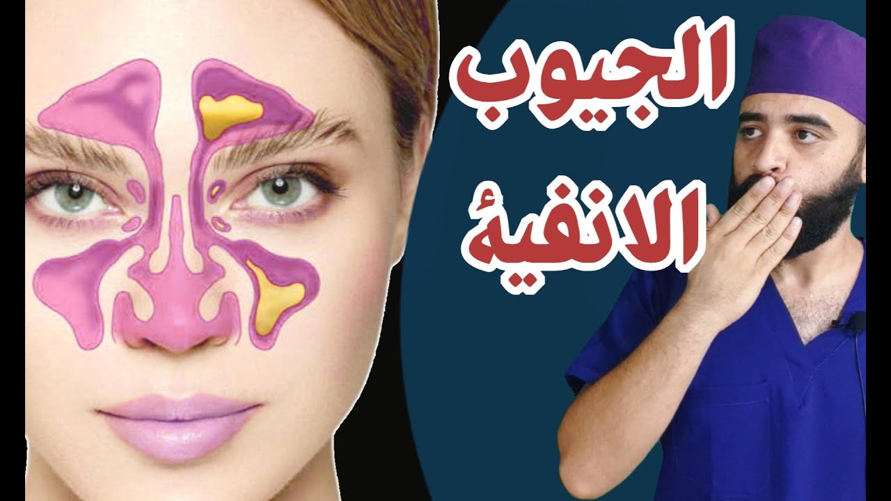 علاج الجيوب الانفية بشكل نهائي بطرق بسيطة بدون مواد كيميائية #مصطفى ...