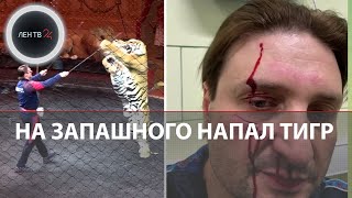 На Запашного напал тигр | Дрессировщику наложили 18 швов