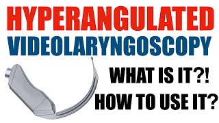 Hyperangulated Videolaryngoscopy: What is it? How do you use it?