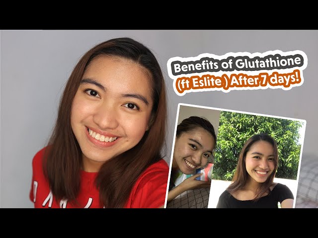 glutathione review philippines BEST GLUTATHIONE PILLS 2021 (Eslite Review, Philippines) | Geraldine  Gallardo