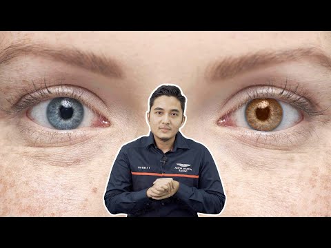 Video: Adakah mata biru hijau hazel?