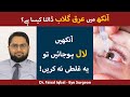 Eye Redness Ka Ilaj Red Eyes Causes Red Eye Infection Treatment Aankhon Ka Laal Ho Jana Eye Redness Ka Ilaj Red Eyes Causes Red Eye Infection Treatment Aankhon Ka Laal Ho Jana