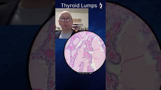 Thyroid pathology lecture - Trailer
