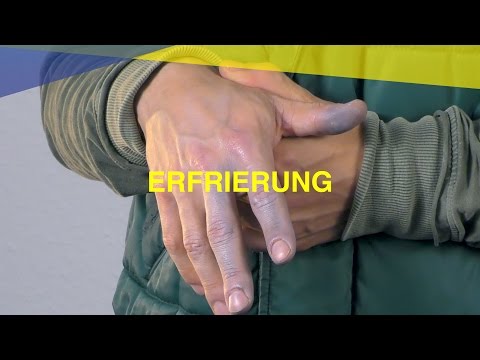 Video: So verbinden Sie Finger oder Zehen: Auf Pausen prüfen + Erste-Hilfe-Tipps