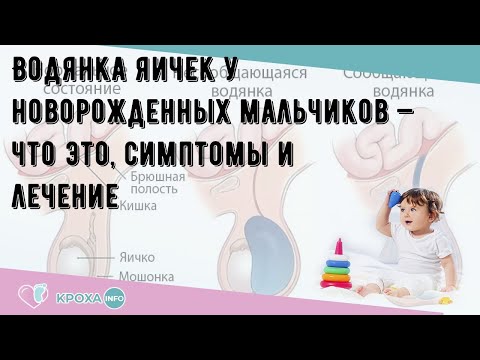 Водянка яичек у новорожденных мальчиков — что это, симптомы и лечение