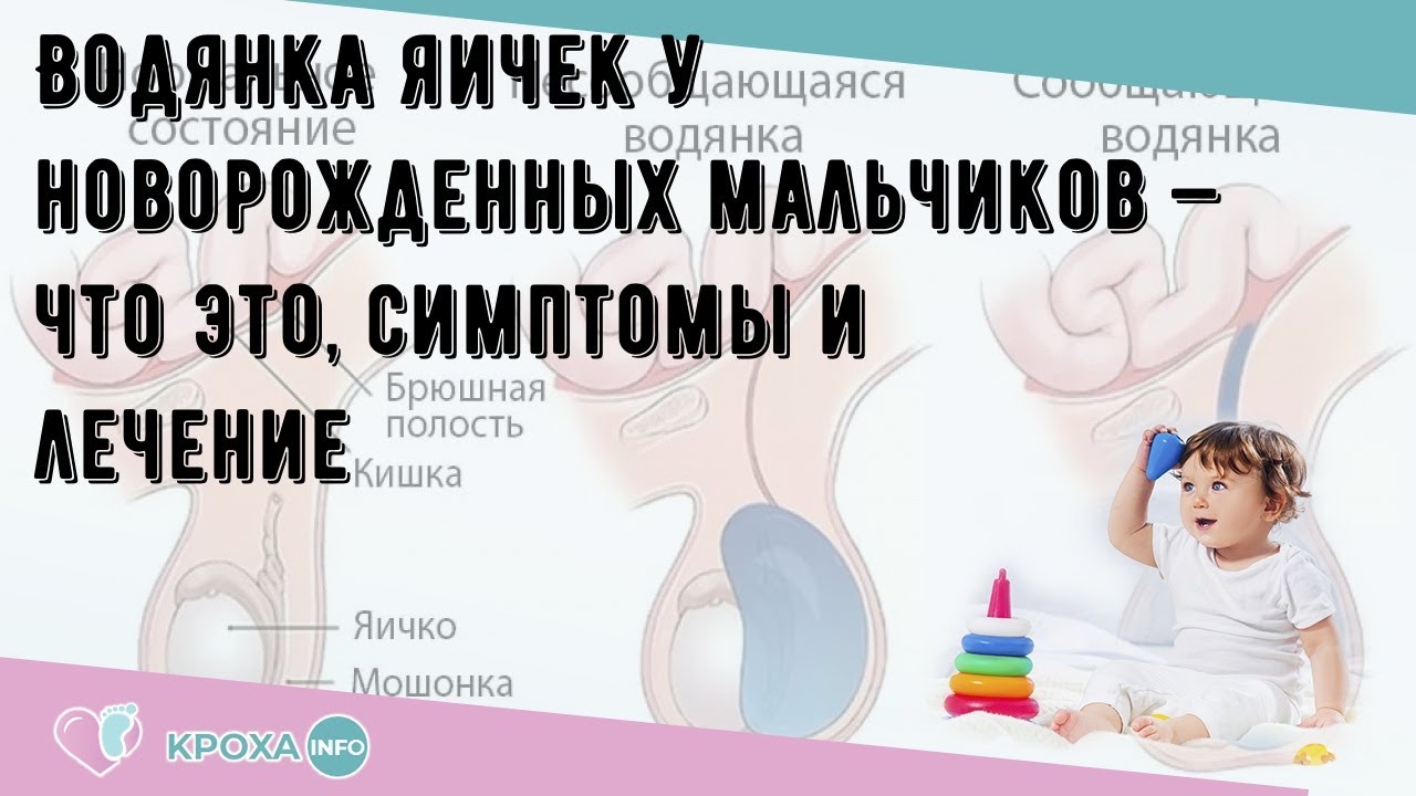Водянка яичек у новорожденных мальчиков — что это, симптомы и лечение ...