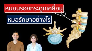 หมอนรองกระดูกสันหลังเคลื่อนทับเส้นประสาท รักษายังไง | EasyDoc Family Talk EP.10