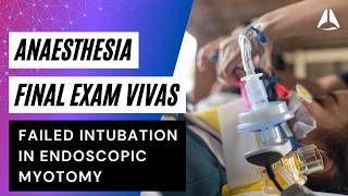 Final Exam Viva - PerOral Endoscopic Myotomy Failed intubated | #anaesthesia #anesthesiology #exam