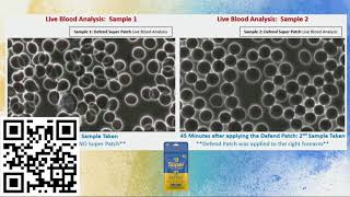 Famous Live Blood Analysis using Defend Super Patch Profile