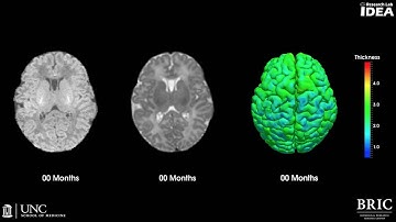 Brain development image progression