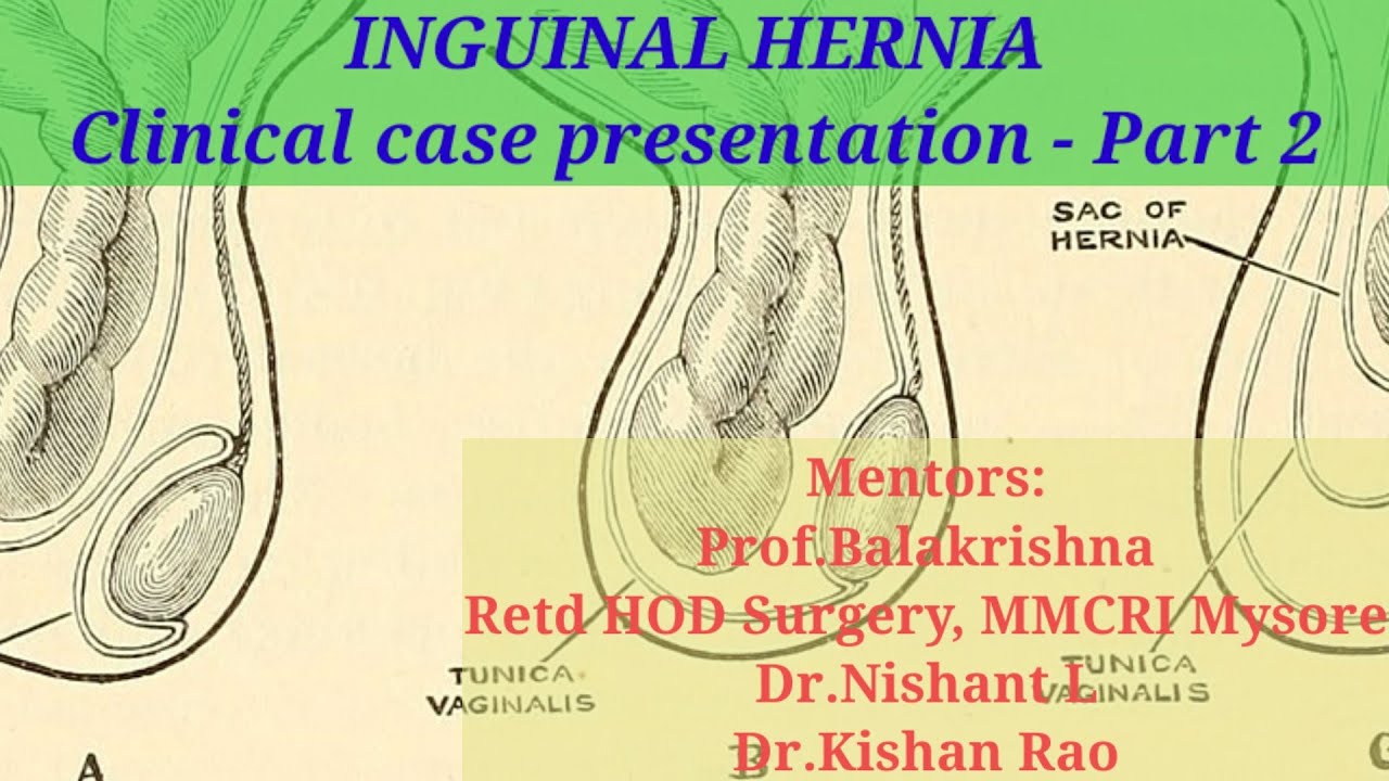 case presentation hernia