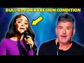 Judges In Tears This Singer Proves Beauty Has No Limits Judges In Tears This Singer Proves Beauty Has No Limits