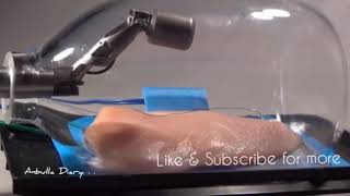 The future of surgery is not about blood and guts