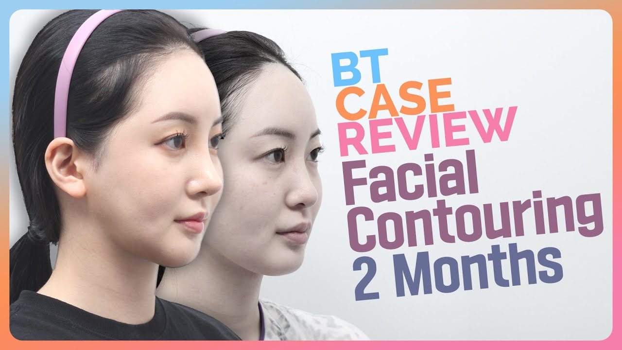 Amazing Results! Mandible Reduction and Chin Surgery at BT Plastic Surgery