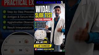 🩸 Widal Slide Test Practical 🔬 | Typhoid Test Demonstration | Lab Technician Practical #Shorts #nabl