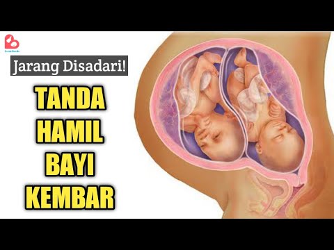 Video: Jarang punya anak kembar empat?