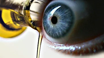 Can castor oil damage your eyes?