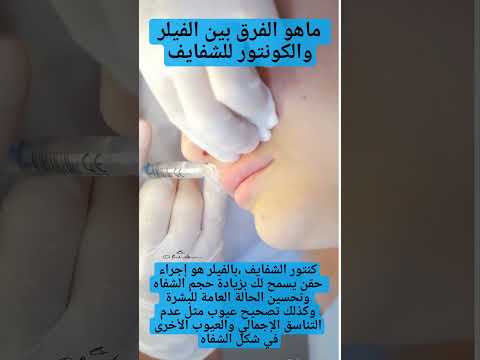 ماهو الفرق بين الفيلر والكونتور للشفايف أشكال فيلر الشفايف انواع تكبير الشفايف