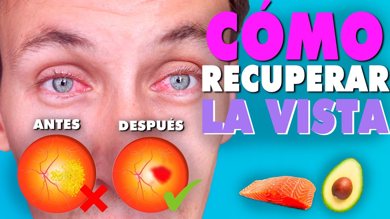 5 CONSEJOS PARA CUIDAR TUS OJOS Y PREVENIR PROBLEMAS DE VISIÓN - YouTube