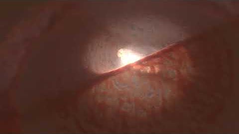 Artistic animation of the warped and torned apart disc of GW Orionis