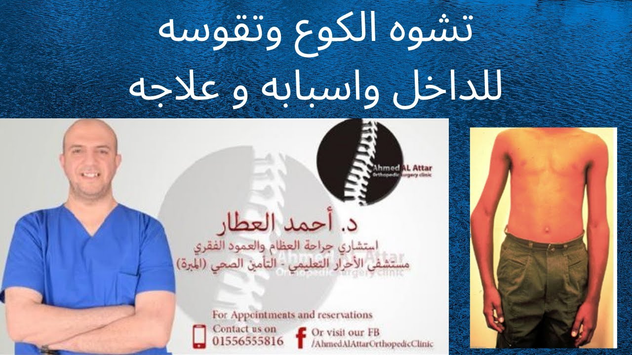 تشوه الكوع وتقوسه للداخل واسبابه و علاجه - د احمد العطار
