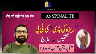 Spinal TB. Diagnosis & Treatment: Urdu / Hindi | Dr. Ali Hassan