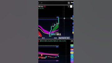 Epic SPY Stock Options Trade