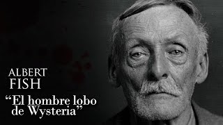 ALBERT FISH - EL HOMBRE LOBO DE WYSTERIA