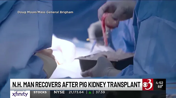 Another New Hampshire man gets a pig kidney as transplant trials are poised to start - clipped ve...