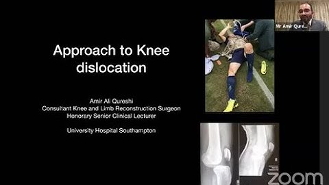 Approach to Knee dislocation ( Mr. Amir Ali Qureshi )