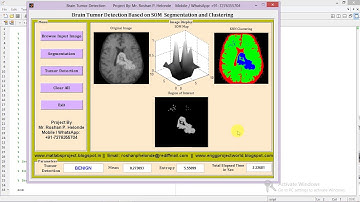 Matlab Code for Brain Tumor Detection and Classification Using Image Processing