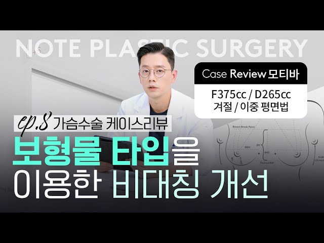 [가슴리뷰] 가슴방 비대칭 l 흉곽 비대칭 l 볼륨 비대칭 l 모티바