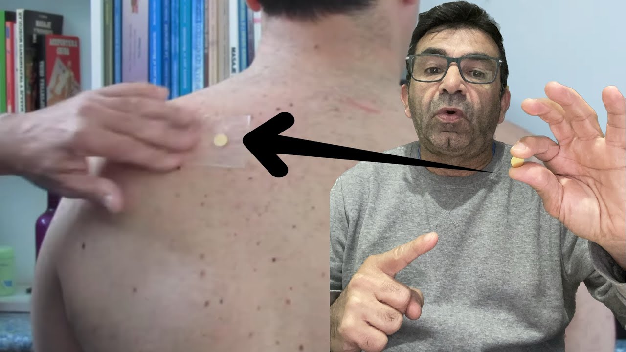 Como poner un imán.