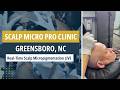 Real-Time Scalp Micropigmentation LIVE — Scalp Micro Pro Clinic