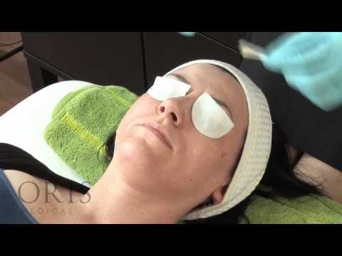 Chemical peels training-Oris Medical