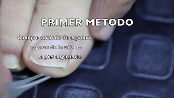 ¿Cómo se coloca el hilo dental debajo de una uña encarnada?