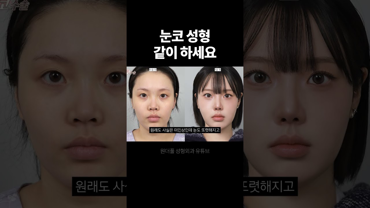 [Вондерфул Гоо сайхны мэс заслын эмнэлэг] Нүд, хамрын гоо сайхны мэс заслыг нэг дор хийлгээрэй.