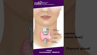 What is Thyroid Nodule Explained by Dr. Atul Rewatkar.