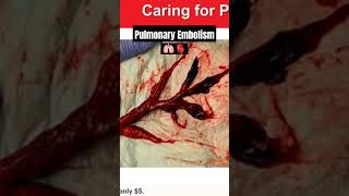 Caring for Post-Operative Patients #CNA #PCT #LPN #RN