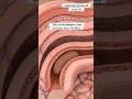 “This Is the Moment Your Intestine Says ‘No More | Gut Health | Anatomy Stomach Arts Uk