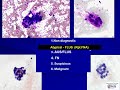 Thyroid Cytology I: Approach