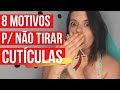 8 Motivos para PARAR de TIRAR AS CUTÍCULAS | #30DicasEm30Dias