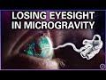 Dangers of Microgravity For The Human Body