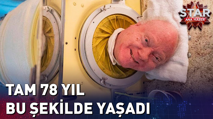 Demir Akciğerde Yaşayan Adam Hayatını Kaybetti | Star Ana Haber