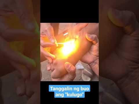 Video: Paano Makilala ang Mga Sintomas ng Bites ng Mite: 12 Mga Hakbang (na may Mga Larawan)