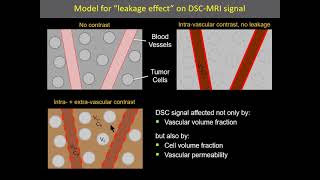 ISMRM MR Academy - DSC-MRI: Acquisition Net Worth