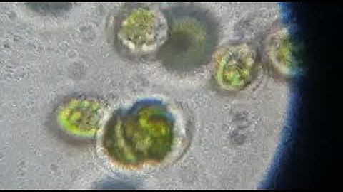 Dividing algal cell #microscope #algae #binaryfission #cytokinesis