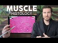 Understanding Muscle Types