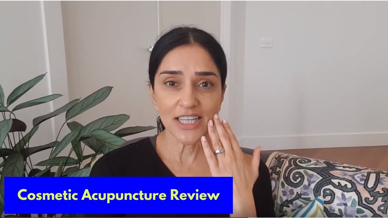Cosmetic Acupuncture Review Dr Sheena Vaughan YouTube