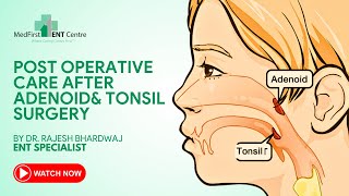 Post Operative Care After Adenoid & tonsil Surgery Explained By Dr. Rajesh Bhardwaj #ENTSurgeon